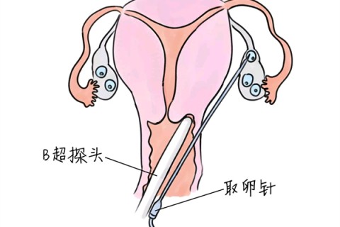http://www.cqyangqi.cn/post/189.html|人工试管